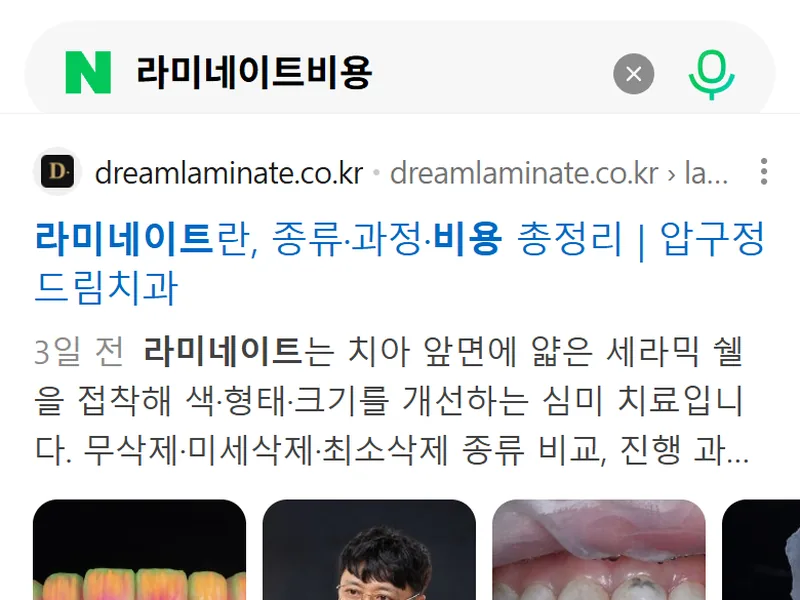 네이버 모바일에서 라미네이트비용을 검색했을 때 광고 아래 첫 일반 검색 결과로 나온 압구정 드림치과 페이지, 2026년 9월 14일 캡처