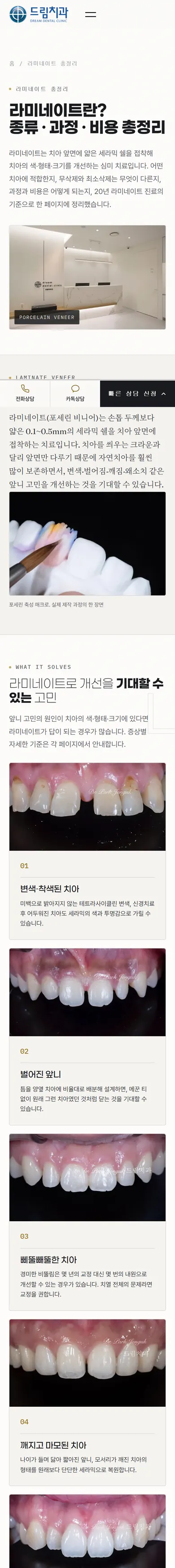 압구정 드림치과 라미네이트 페이지 모바일 화면 전체